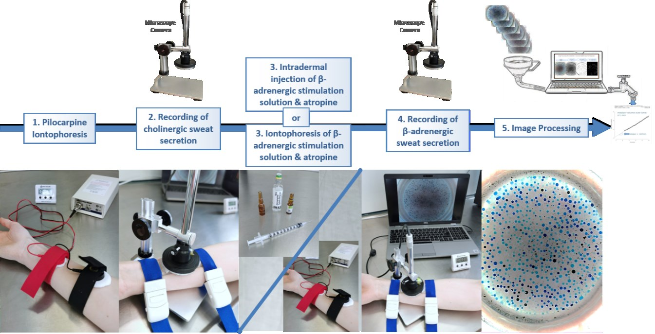 Stimulation, acquisition and analysis workflow: 1. "normal"/reference sweat reaction induction 2. first time series image acquisition 3. cystic fibrosis specific stimulation; either via needle injection or iontophoresis 4. second time series image acquisition 5. image processing for quantification of rates